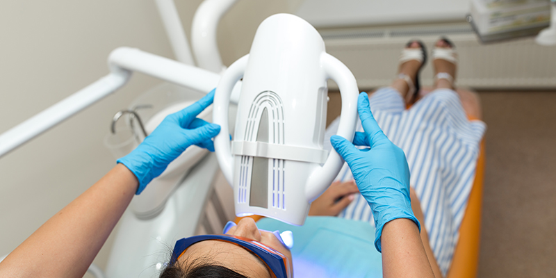 医療ホワイトニング(専属歯科医監修)